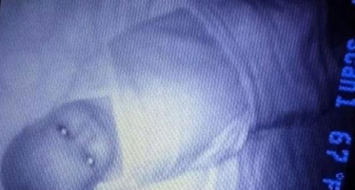 Gördüklerine İnanamadı galerisi resim 13