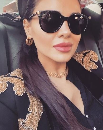 Azeri kızı Günel estetiğe doymuyor! galerisi resim 7