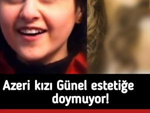 Azeri kızı Günel estetiğe doymuyor!