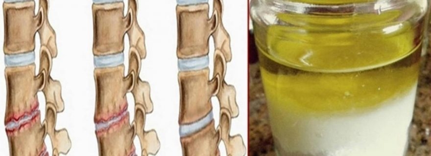 TUZ VE ZEYTİNYAĞI galerisi resim 5