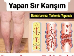 DAMARLARINIZ TERTEMİZ OLACAK