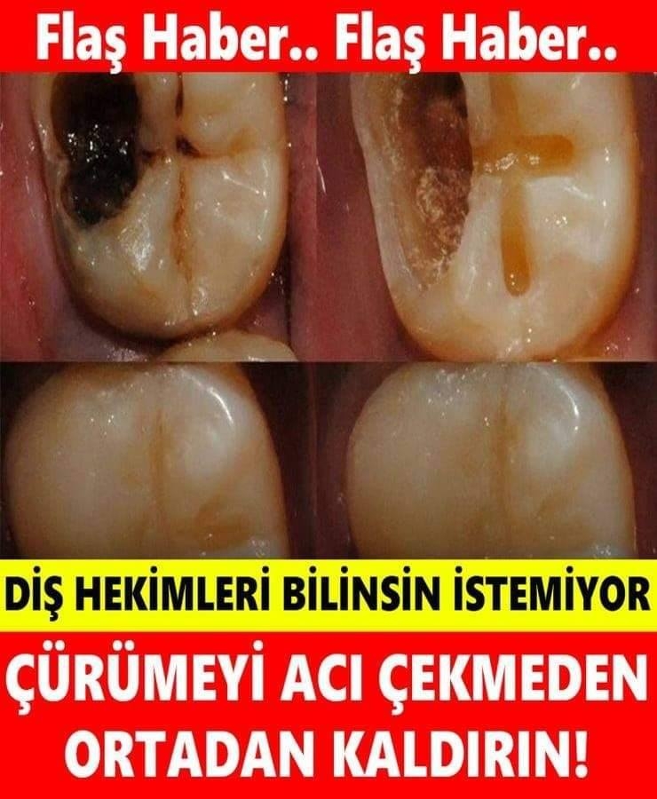 Diş Hekimleri Bunun Bilinmesini İstemez galerisi resim 1