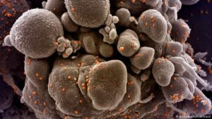 PROF.DR. ATEŞ KARA GERÇEĞİ AÇIKLADI galerisi resim 3