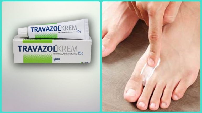 Travazol krem nedir ve nerelerde kullanılır galerisi resim 3