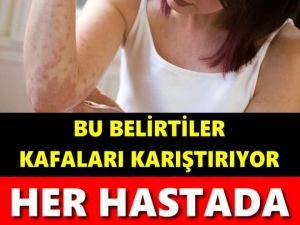 COVİD-19 BELİRTİLERİ KAFALARI KARIŞTIRDI! HER HASTADA BİRBİRİNDEN FARKLI
