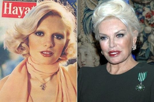 Herkesi Şokk Etti galerisi resim 2