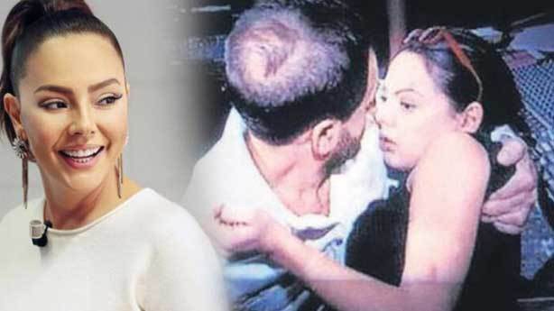 Ünlülerin Çok Bilinmeyen Hastalıkları galerisi resim 22