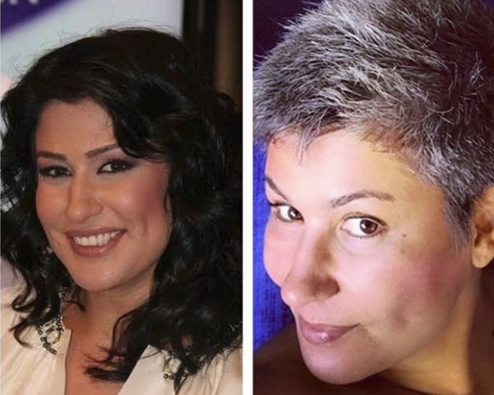 Ünlülerin Çok Bilinmeyen Hastalıkları galerisi resim 5