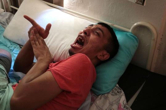 Protein tozu içti felç kaldı galerisi resim 3