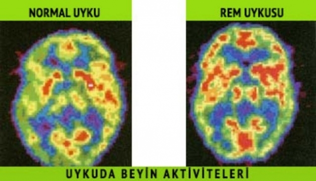 Hepimizin Ortak Kabusu Karabasan! galerisi resim 5