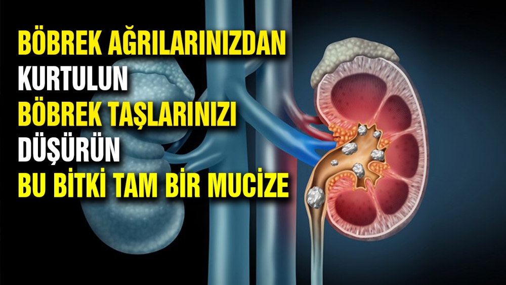 Bu bitki sizi kuratacak. galerisi resim 2