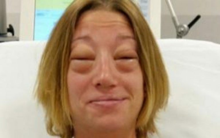 EŞEK SÜTÜ galerisi resim 2