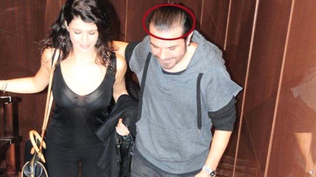 Beren Saat'in gizlediği gerçek ortaya çıktı! galerisi resim 6