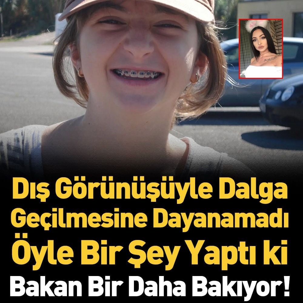 Dış görünüşüyle dalga geçilmesine dayanamadı öyle bir şey yaptı ki galerisi resim 1