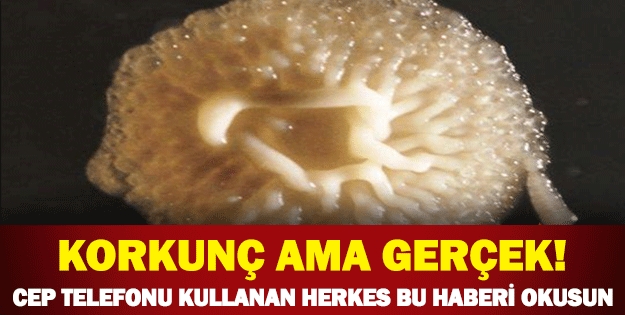 Cep telefonu kullananlar dikkat! galerisi resim 1