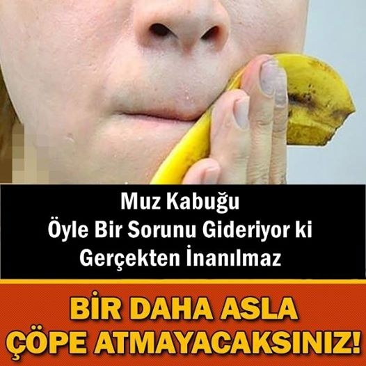 Muz Kabuğunu Bir Daha Çöpe Atmayacaksınız! galerisi resim 1
