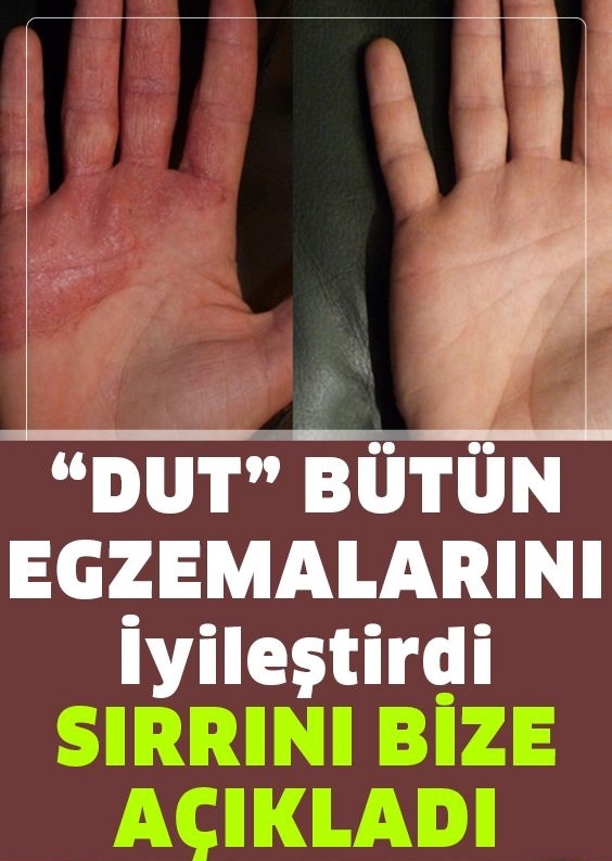 Kuru dutun faydaları galerisi resim 1