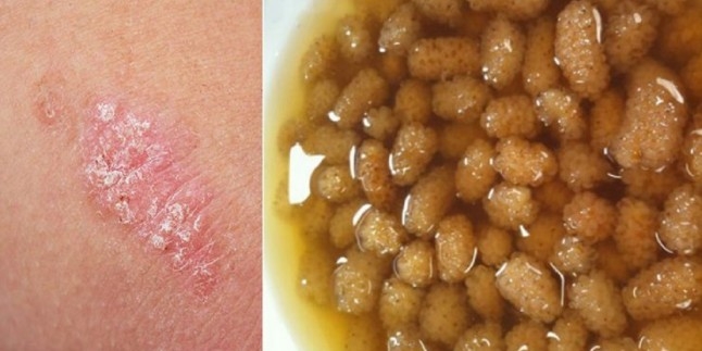 Kuru dutun faydaları galerisi resim 3