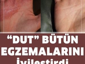 Kuru dutun faydaları