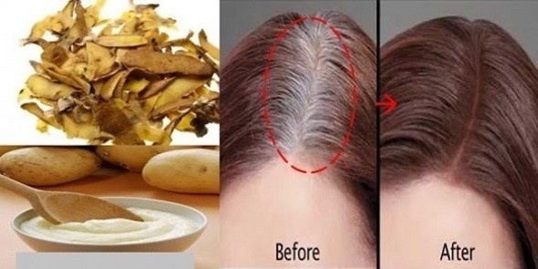 BEYAZ SAÇLARDAN KURTULUN galerisi resim 5