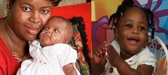 200 Gram Dünyaya gelmişti. Şimdi büyüdü bakın ne halde... galerisi resim 9