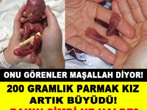 200 Gram Dünyaya gelmişti. Şimdi büyüdü bakın ne halde...