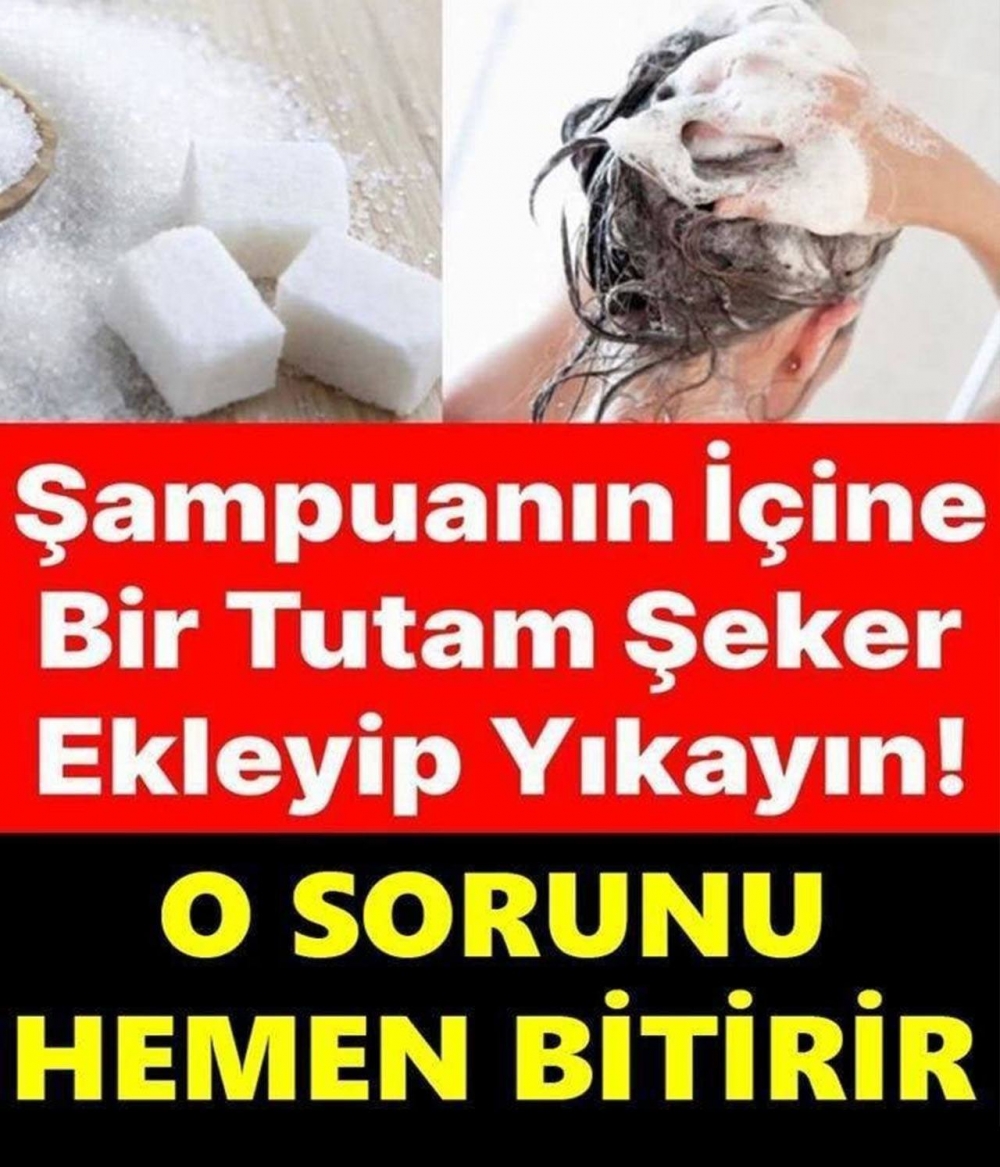Şampuana şeker eklediğinizde bakın neler oluyorr.. galerisi resim 1