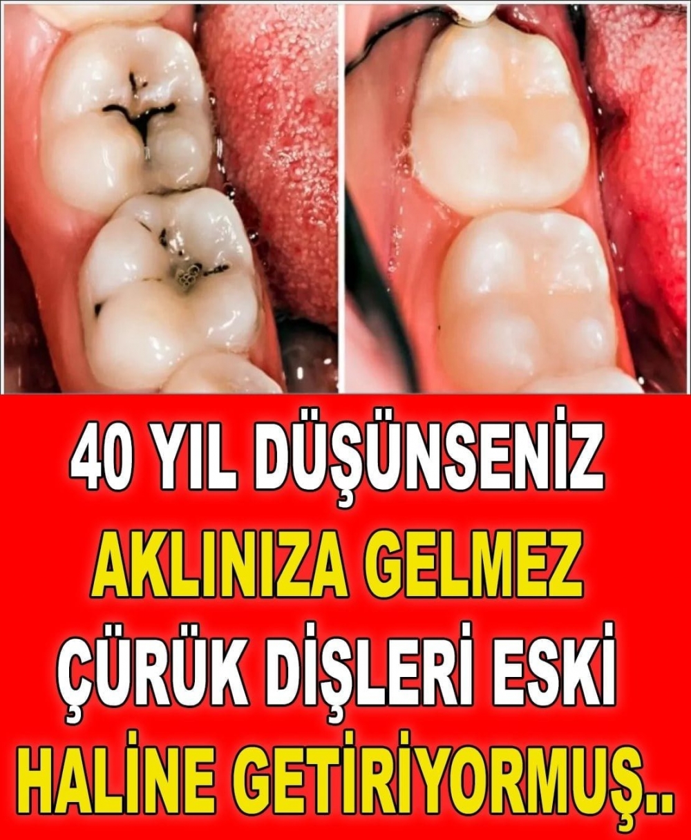Hiç aklıma gelmezdi galerisi resim 1
