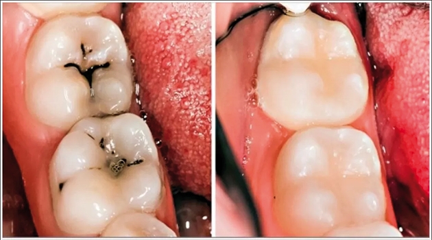 Hiç aklıma gelmezdi galerisi resim 4