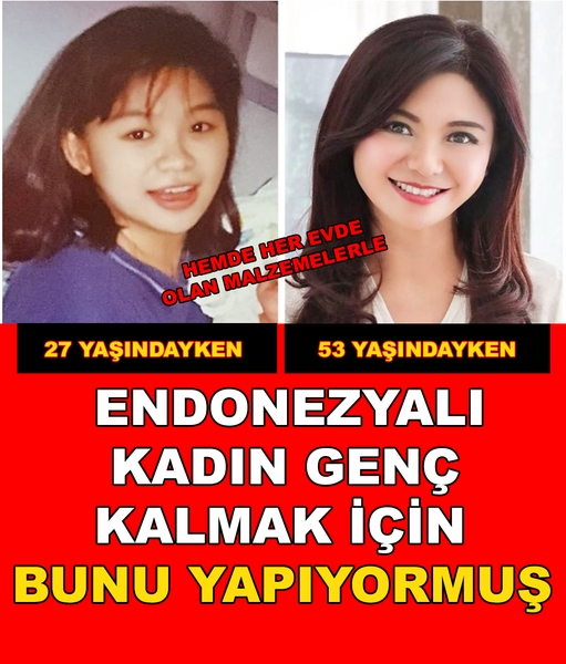 Bunu yapıyormuş galerisi resim 1