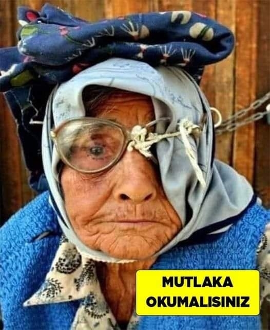 Annemin tek gözü vardı galerisi resim 1