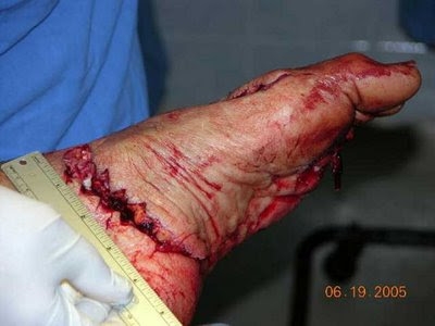 BİR SANİYE SONRA HAYATLARI DEĞİŞTİ....AMACI SADECE TATİL YAPMAKTI... galerisi resim 19