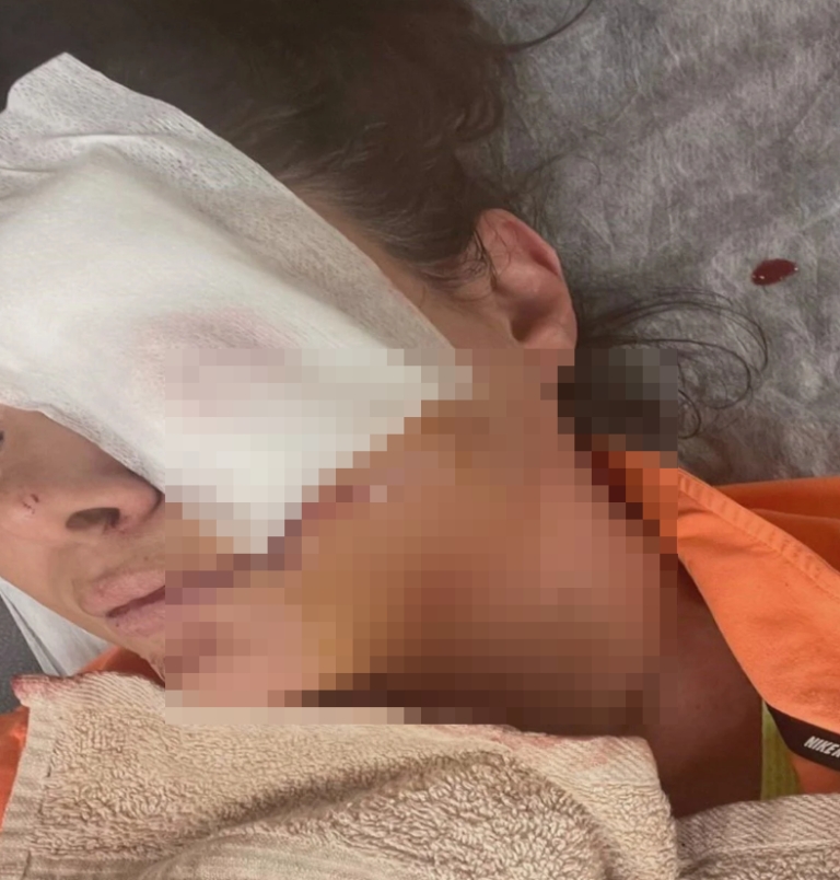 Tuğba Altıntop’un Son Hali Yürek Sızlattı galerisi resim 4