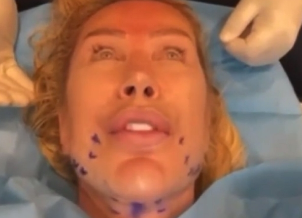 Genç Görünmek İçin galerisi resim 4