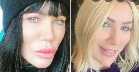 Genç Görünmek İçin galerisi resim 5