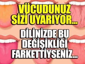 Dilimizde Bu Belirti Varsa..