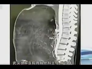 YALNIZCA 3 AYDA BU HALE GELDİ!