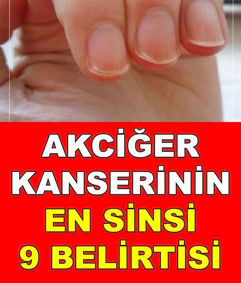 En Sinsi 9 Bulgusu galerisi resim 1