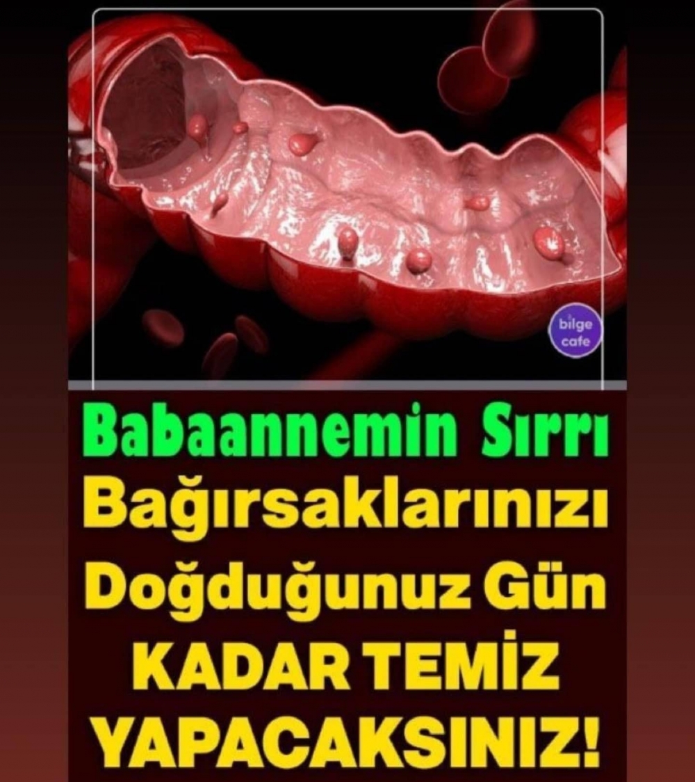 Temizlemenin En İyi Yolu galerisi resim 1