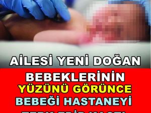 YÜZÜNÜ GÖRÜNCE TERK ETTİ