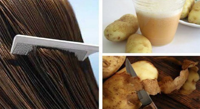 Beyaz Saça Patates Kabuğu ile Son! galerisi resim 2