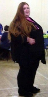 TAM 115 KİLO VERDİ MANKEN GİBİ OLDU ! GÖRENLER ÇILDIRIYOR ! galerisi resim 2