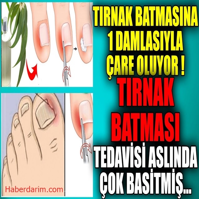 ASLINDA BU KADAR BASİTMİŞ galerisi resim 1