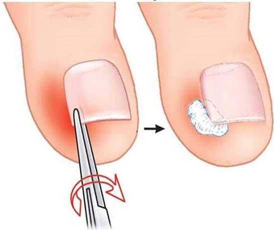 ASLINDA BU KADAR BASİTMİŞ galerisi resim 4