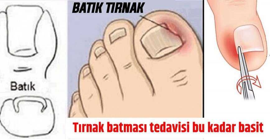 ASLINDA BU KADAR BASİTMİŞ galerisi resim 5