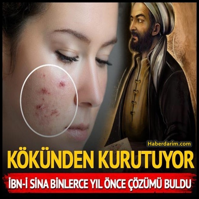 İbn-i Sina tek tek açıkladı! Kökünden kurutuyor galerisi resim 1