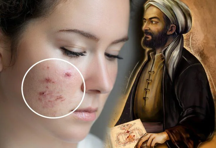 İbn-i Sina tek tek açıkladı! Kökünden kurutuyor galerisi resim 3