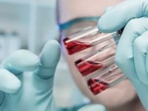 İşte En Şanslı Kan Grubu