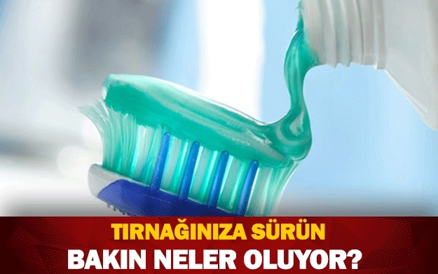 TIRNAĞINIZA SÜRÜN BAKIN NELER OLUYOR? galerisi resim 1