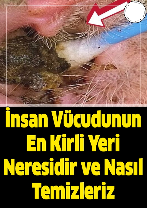 İnsan Vücudunun En Kirli Yeri galerisi resim 1